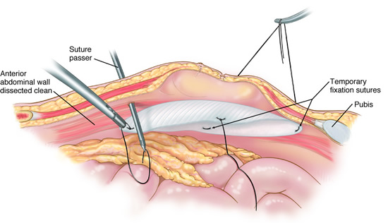 Hanumant Endosurgery Center